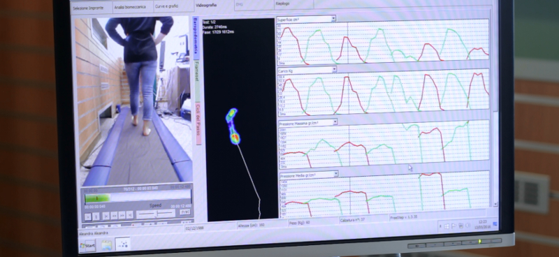 ortopedia a milano per esame computerizzato del passo